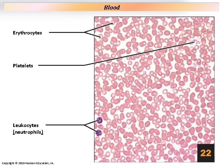 Plate 22 Erythrocytes Platelets Leukocytes (neutrophils) Copyright © 2010 Pearson Education, Inc. Blood Plate 22 Erythrocytes Platelets Leukocytes (neutrophils) Copyright © 2010 Pearson Education, Inc. Blood