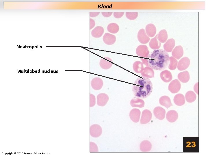 Plate 23 Neutrophils Multilobed nucleus Copyright © 2010 Pearson Education, Inc. Blood Plate 23 Neutrophils Multilobed nucleus Copyright © 2010 Pearson Education, Inc. Blood