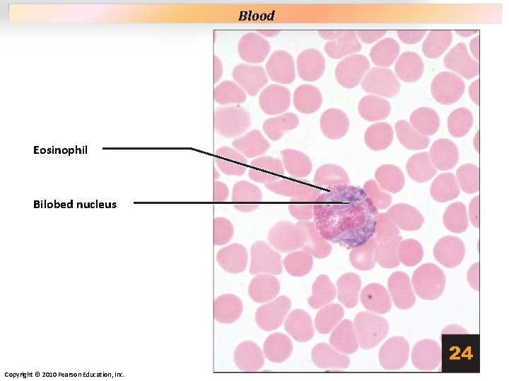Plate 24 Eosinophil Bilobed nucleus Copyright © 2010 Pearson Education, Inc. Blood Plate 24 Eosinophil Bilobed nucleus Copyright © 2010 Pearson Education, Inc. Blood