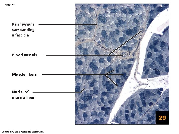 Plate 29 Perimysium surrounding a fascicle Blood vessels Muscle fibers Nuclei of muscle fiber Plate 29 Perimysium surrounding a fascicle Blood vessels Muscle fibers Nuclei of muscle fiber