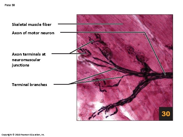 Plate 30 Skeletal muscle fiber Axon of motor neuron Axon terminals at neuromuscular junctions Plate 30 Skeletal muscle fiber Axon of motor neuron Axon terminals at neuromuscular junctions
