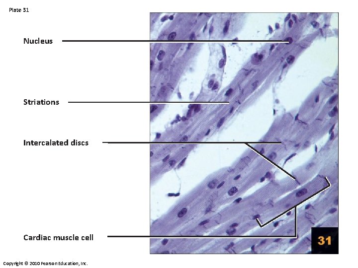 Plate 31 Nucleus Striations Intercalated discs Cardiac muscle cell Copyright © 2010 Pearson Education, Plate 31 Nucleus Striations Intercalated discs Cardiac muscle cell Copyright © 2010 Pearson Education,