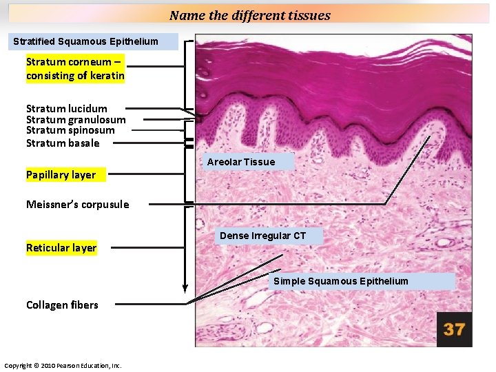 Plate 37 Name the different tissues Stratified Squamous Epithelium Stratum corneum – consisting of Plate 37 Name the different tissues Stratified Squamous Epithelium Stratum corneum – consisting of