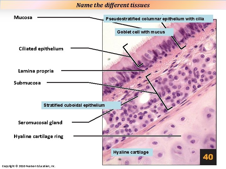 Name the different tissues Plate 40 Mucosa Pseudostratified columnar epithelium with cilia Goblet cell Name the different tissues Plate 40 Mucosa Pseudostratified columnar epithelium with cilia Goblet cell