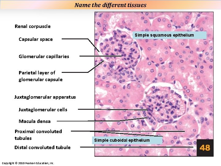 Name the different tissues Plate 48 Renal corpuscle Capsular space Simple squamous epithelium Glomerular Name the different tissues Plate 48 Renal corpuscle Capsular space Simple squamous epithelium Glomerular