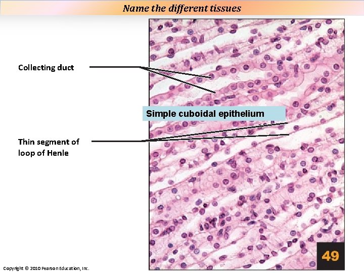 Plate 49 Name the different tissues Collecting duct Simple cuboidal epithelium Thin segment of Plate 49 Name the different tissues Collecting duct Simple cuboidal epithelium Thin segment of