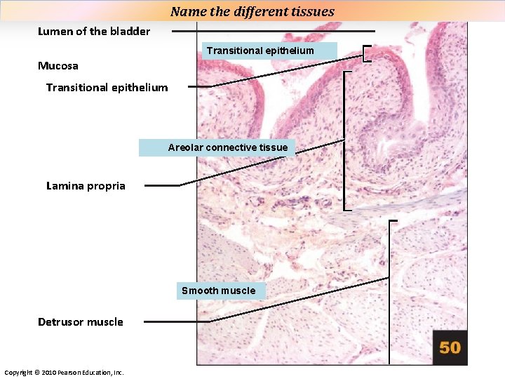 Name the different tissues Plate 50 Lumen of the bladder Transitional epithelium Mucosa Transitional Name the different tissues Plate 50 Lumen of the bladder Transitional epithelium Mucosa Transitional