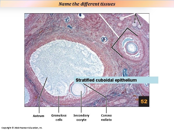Name the different tissues Plate 52 Stratified cuboidal epithelium Antrum Copyright © 2010 Pearson Name the different tissues Plate 52 Stratified cuboidal epithelium Antrum Copyright © 2010 Pearson
