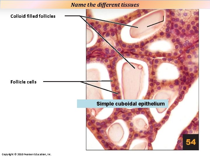 Plate 54 Name the different tissues Colloid filled follicles Follicle cells Simple cuboidal epithelium Plate 54 Name the different tissues Colloid filled follicles Follicle cells Simple cuboidal epithelium