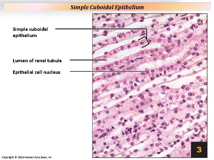 Plate 3 Simple cuboidal epithelium Lumen of renal tubule Epithelial cell nucleus Copyright © Plate 3 Simple cuboidal epithelium Lumen of renal tubule Epithelial cell nucleus Copyright ©