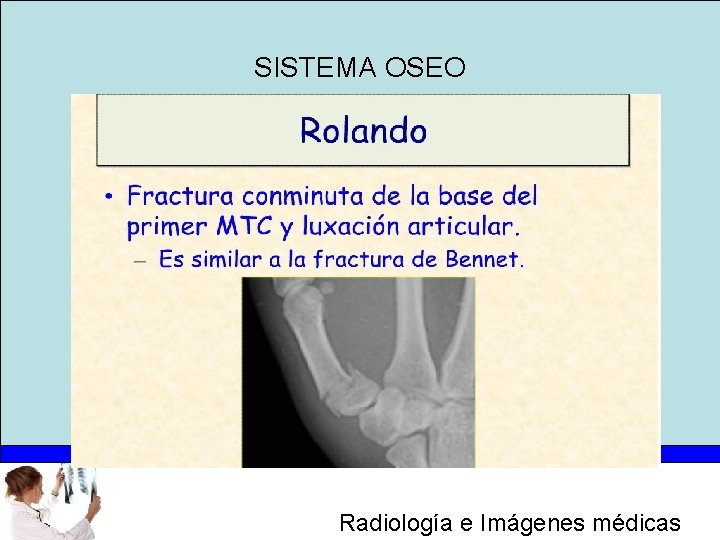 SISTEMA OSEO Radiología e Imágenes médicas 