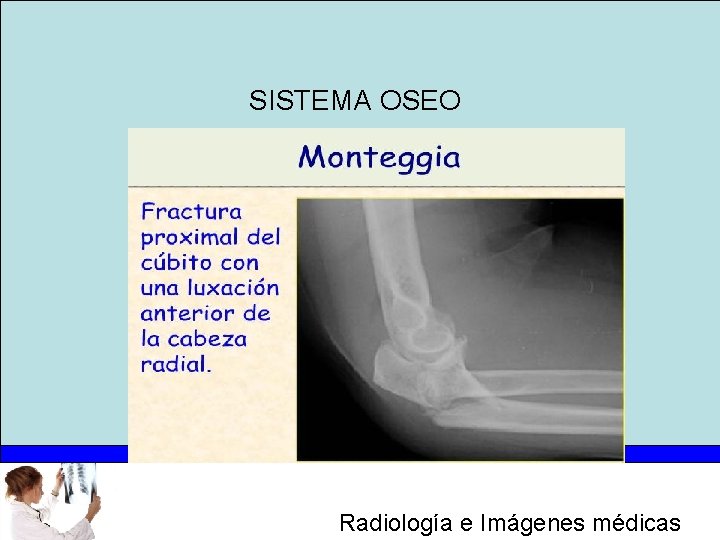 SISTEMA OSEO Radiología e Imágenes médicas 