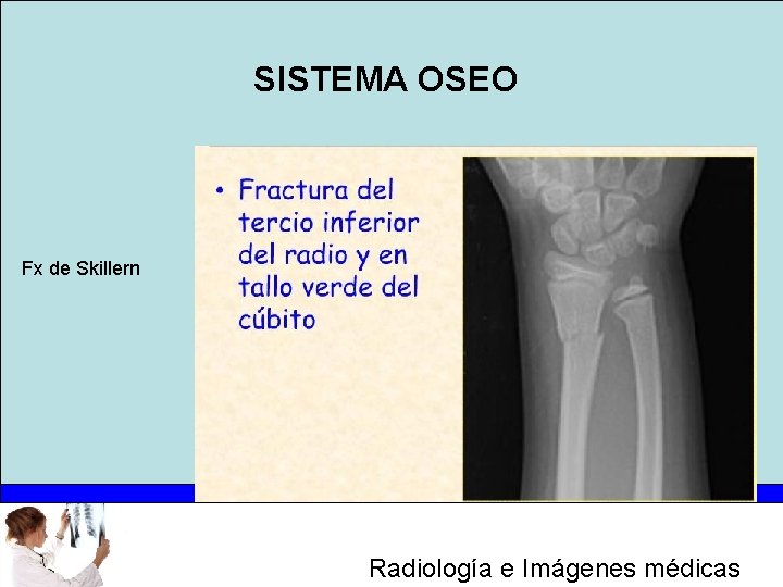 SISTEMA OSEO Fx de Skillern Radiología e Imágenes médicas 