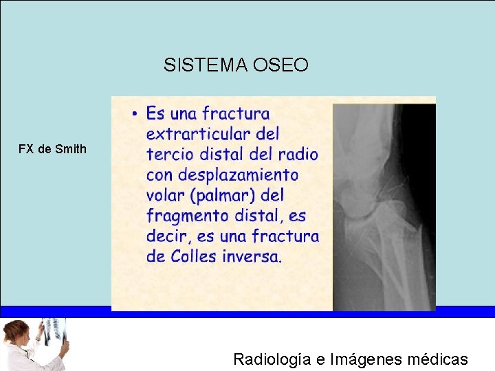 SISTEMA OSEO FX de Smith Radiología e Imágenes médicas 