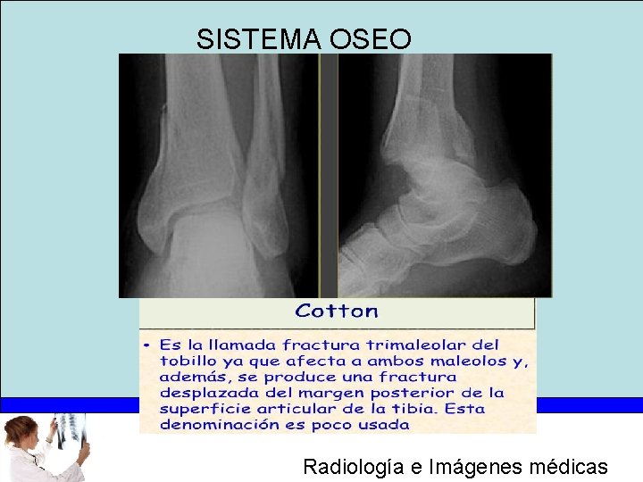 SISTEMA OSEO Radiología e Imágenes médicas 