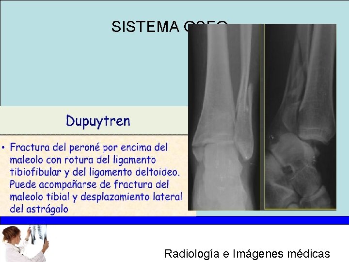 SISTEMA OSEO Radiología e Imágenes médicas 