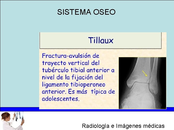 SISTEMA OSEO Radiología e Imágenes médicas 