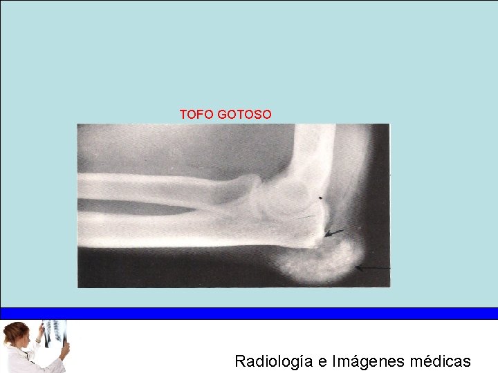 TOFO GOTOSO Radiología e Imágenes médicas 