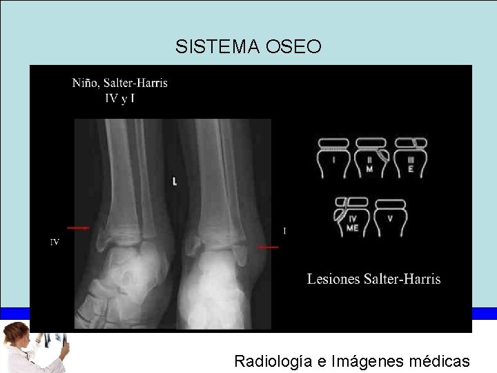 SISTEMA OSEO Radiología e Imágenes médicas 