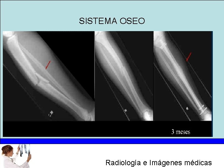 SISTEMA OSEO Radiología e Imágenes médicas 