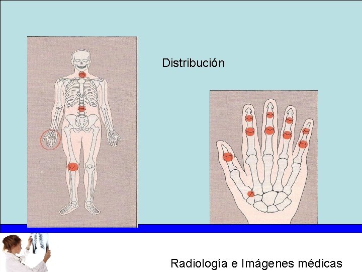 Distribución Radiología e Imágenes médicas 