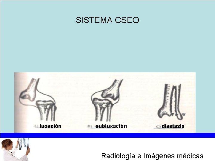 SISTEMA OSEO luxación subluxación diastasis Radiología e Imágenes médicas 