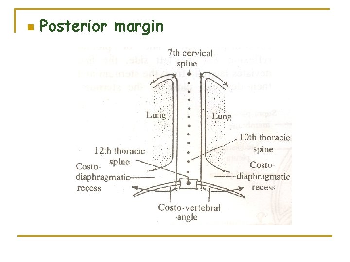 n Posterior margin 