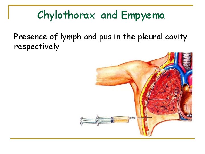 Chylothorax and Empyema Presence of lymph and pus in the pleural cavity respectively 