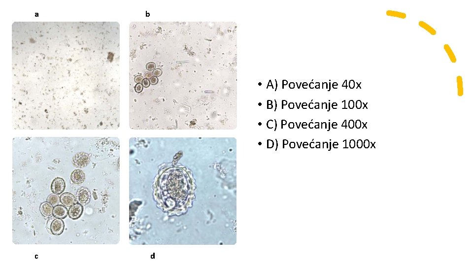 a b • A) Povećanje 40 x • B) Povećanje 100 x • C) a b • A) Povećanje 40 x • B) Povećanje 100 x • C)