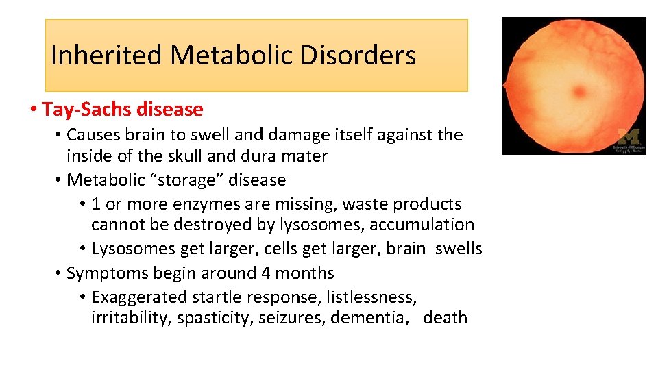 Inherited Metabolic Disorders • Tay-Sachs disease • Causes brain to swell and damage itself