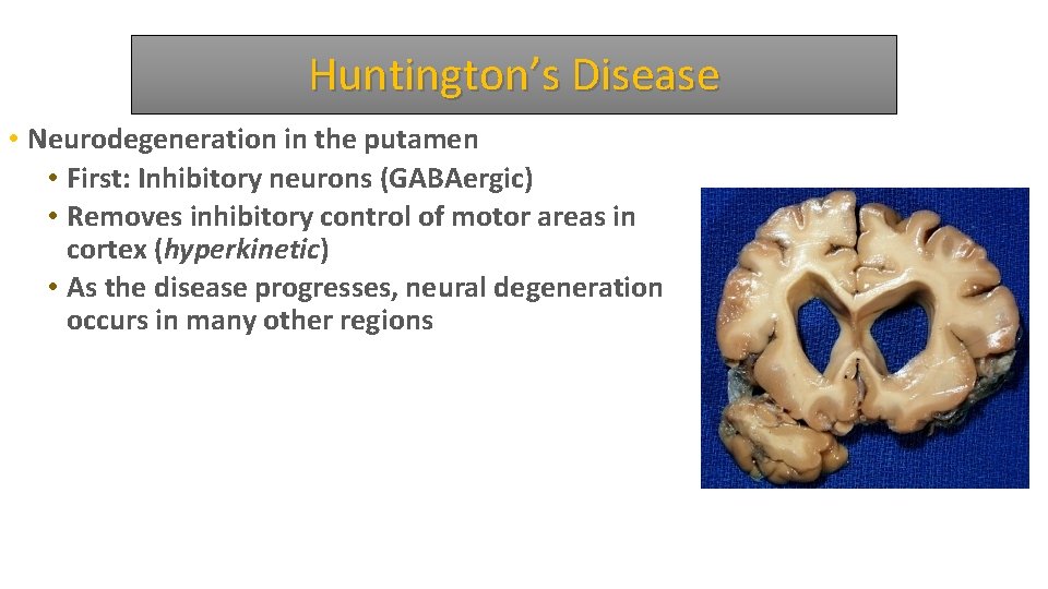 Huntington’s Disease • Neurodegeneration in the putamen • First: Inhibitory neurons (GABAergic) • Removes