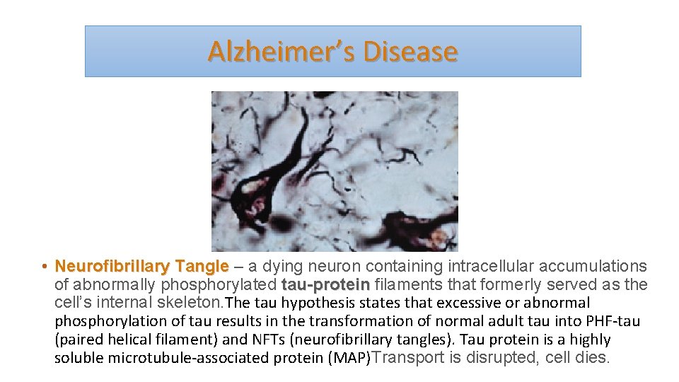 Alzheimer’s Disease • Neurofibrillary Tangle – a dying neuron containing intracellular accumulations of abnormally