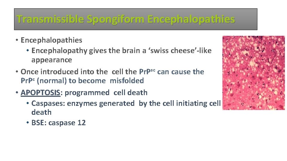 Transmissible Spongiform Encephalopathies • Encephalopathies • Encephalopathy gives the brain a ‘swiss cheese’-like appearance