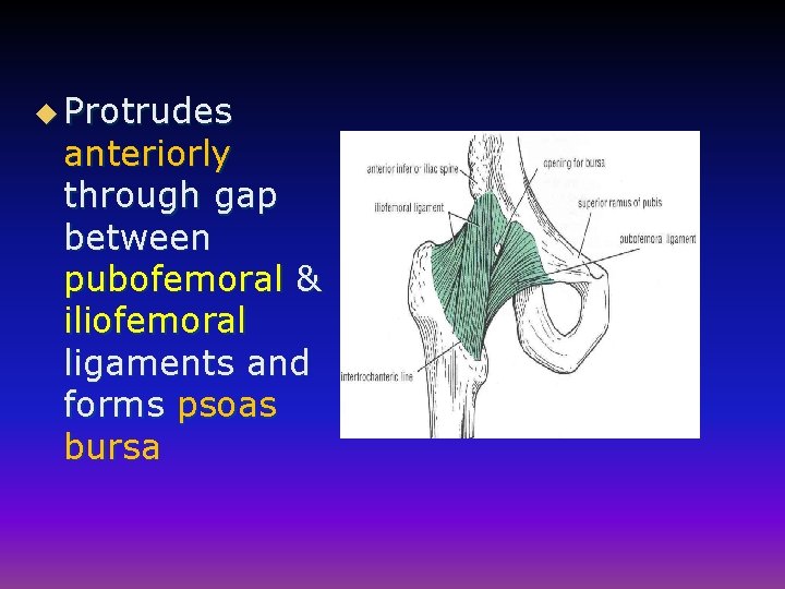 u Protrudes anteriorly through gap between pubofemoral & iliofemoral ligaments and forms psoas bursa