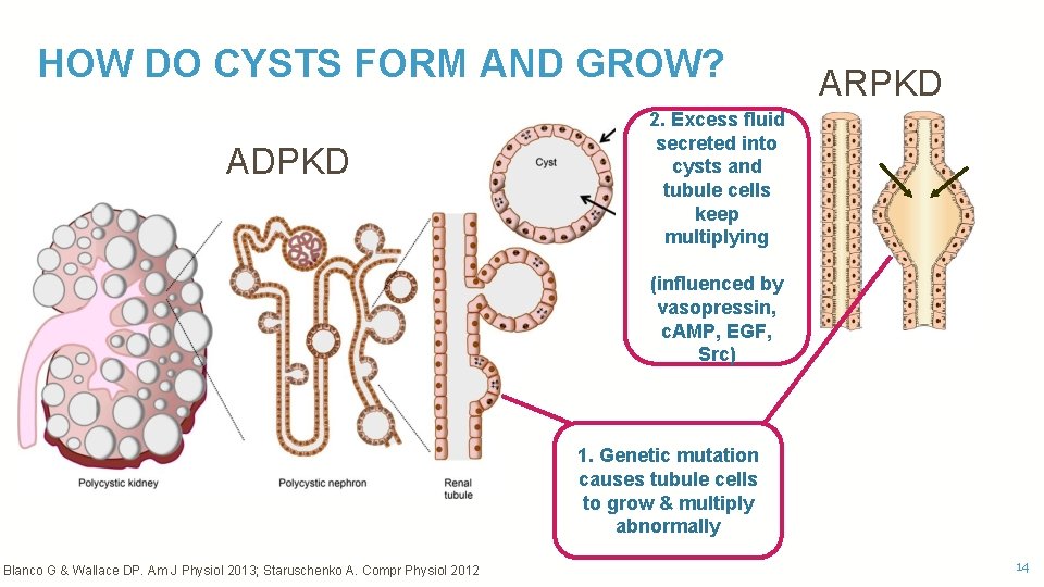 HOW DO CYSTS FORM AND GROW? ADPKD ARPKD 2. Excess fluid secreted into cysts
