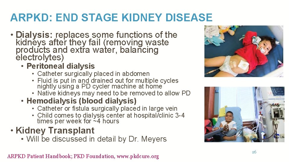 ARPKD: END STAGE KIDNEY DISEASE • Dialysis: replaces some functions of the kidneys after