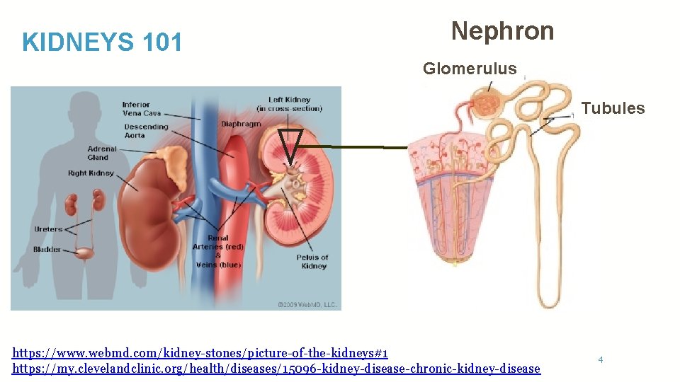 KIDNEYS 101 Nephron Glomerulus Tubules https: //www. webmd. com/kidney-stones/picture-of-the-kidneys#1 https: //my. clevelandclinic. org/health/diseases/15096 -kidney-disease-chronic-kidney-disease
