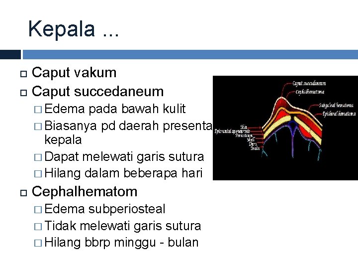 Kepala. . . Caput vakum Caput succedaneum � Edema pada bawah kulit � Biasanya