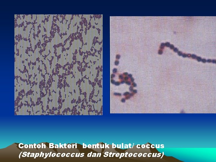 Contoh Bakteri bentuk bulat/ coccus (Staphylococcus dan Streptococcus) 