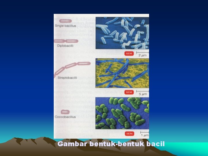 Gambar bentuk-bentuk bacil 