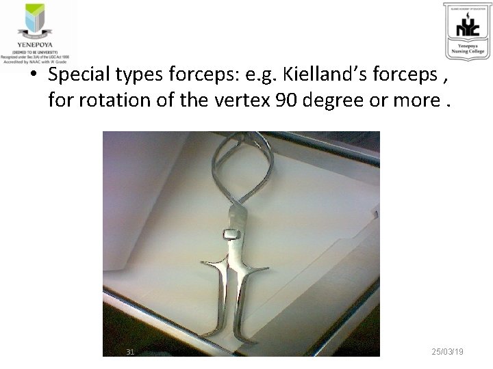  • Special types forceps: e. g. Kielland’s forceps , for rotation of the