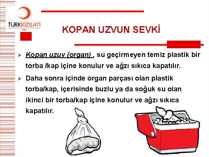 KOPAN UZVUN SEVKİ Ø Kopan uzuv (organ) , su geçirmeyen temiz plastik bir torba