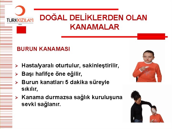 DOĞAL DELİKLERDEN OLAN KANAMALAR BURUN KANAMASI Ø Ø Hasta/yaralı oturtulur, sakinleştirilir, Başı hafifçe öne