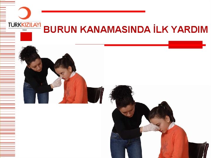 BURUN KANAMASINDA İLK YARDIM 