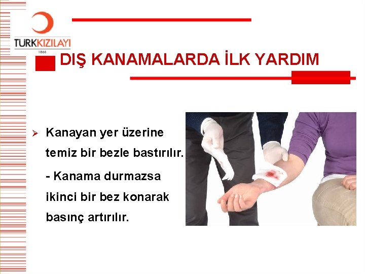 DIŞ KANAMALARDA İLK YARDIM Ø Kanayan yer üzerine temiz bir bezle bastırılır. - Kanama