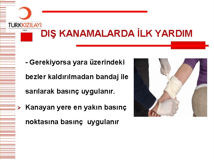 DIŞ KANAMALARDA İLK YARDIM - Gerekiyorsa yara üzerindeki bezler kaldırılmadan bandaj ile sarılarak basınç