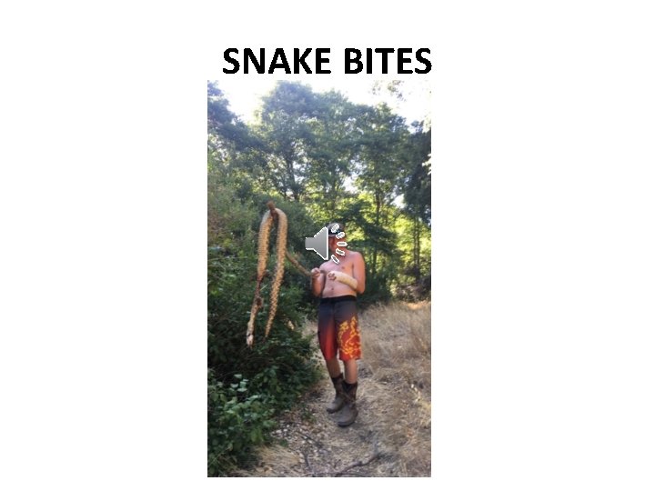 SNAKE BITES 