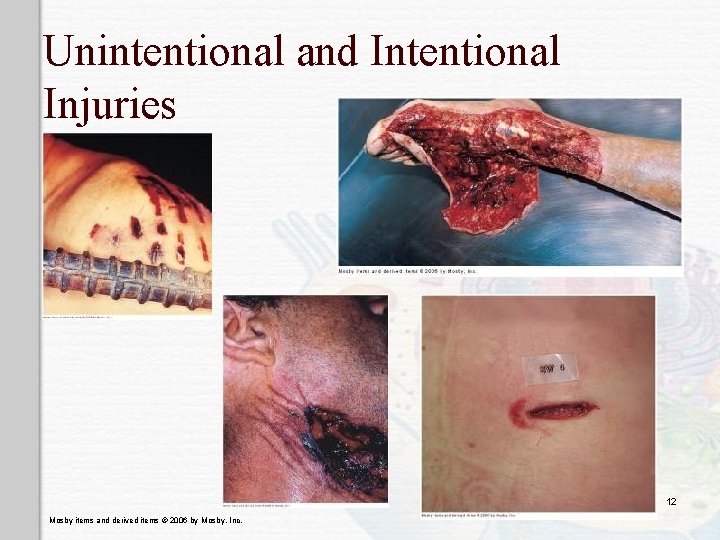 Unintentional and Intentional Injuries 12 Mosby items and derived items © 2006 by Mosby,