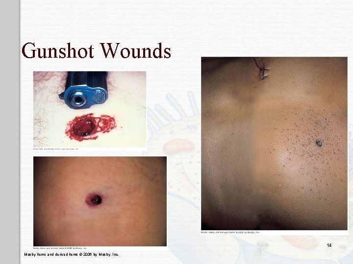 Gunshot Wounds 14 Mosby items and derived items © 2006 by Mosby, Inc. 