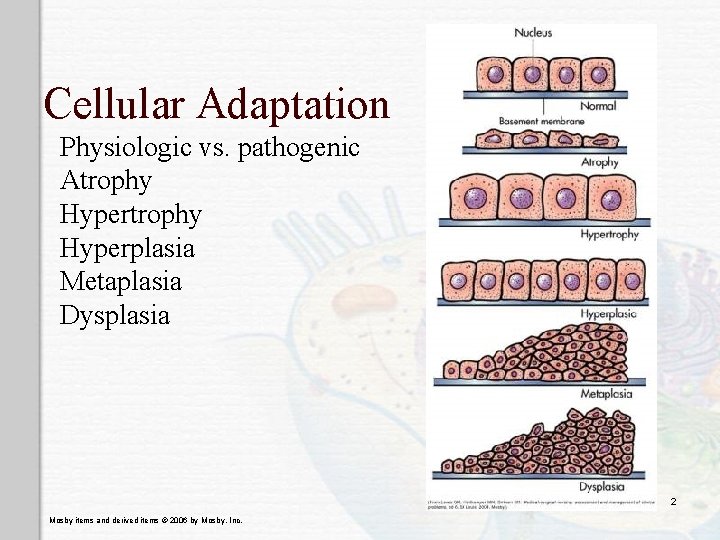 Cellular Adaptation Physiologic vs. pathogenic Atrophy Hyperplasia Metaplasia Dysplasia 2 Mosby items and derived Cellular Adaptation Physiologic vs. pathogenic Atrophy Hyperplasia Metaplasia Dysplasia 2 Mosby items and derived